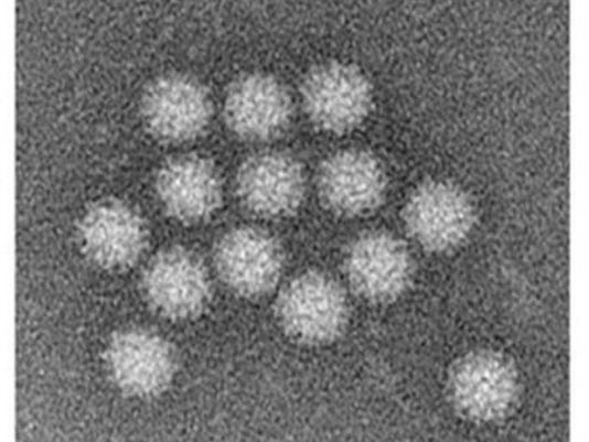 New norovirus bug sweeps nation