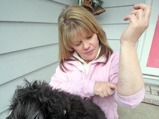 After Rabid Coyote Bite, Orangeburg Woman Starts Treatment