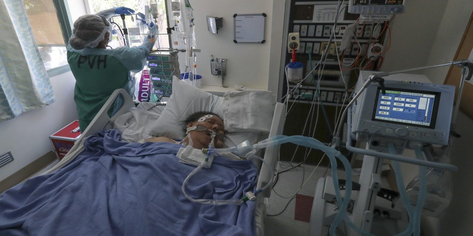 icu patient on ventilator