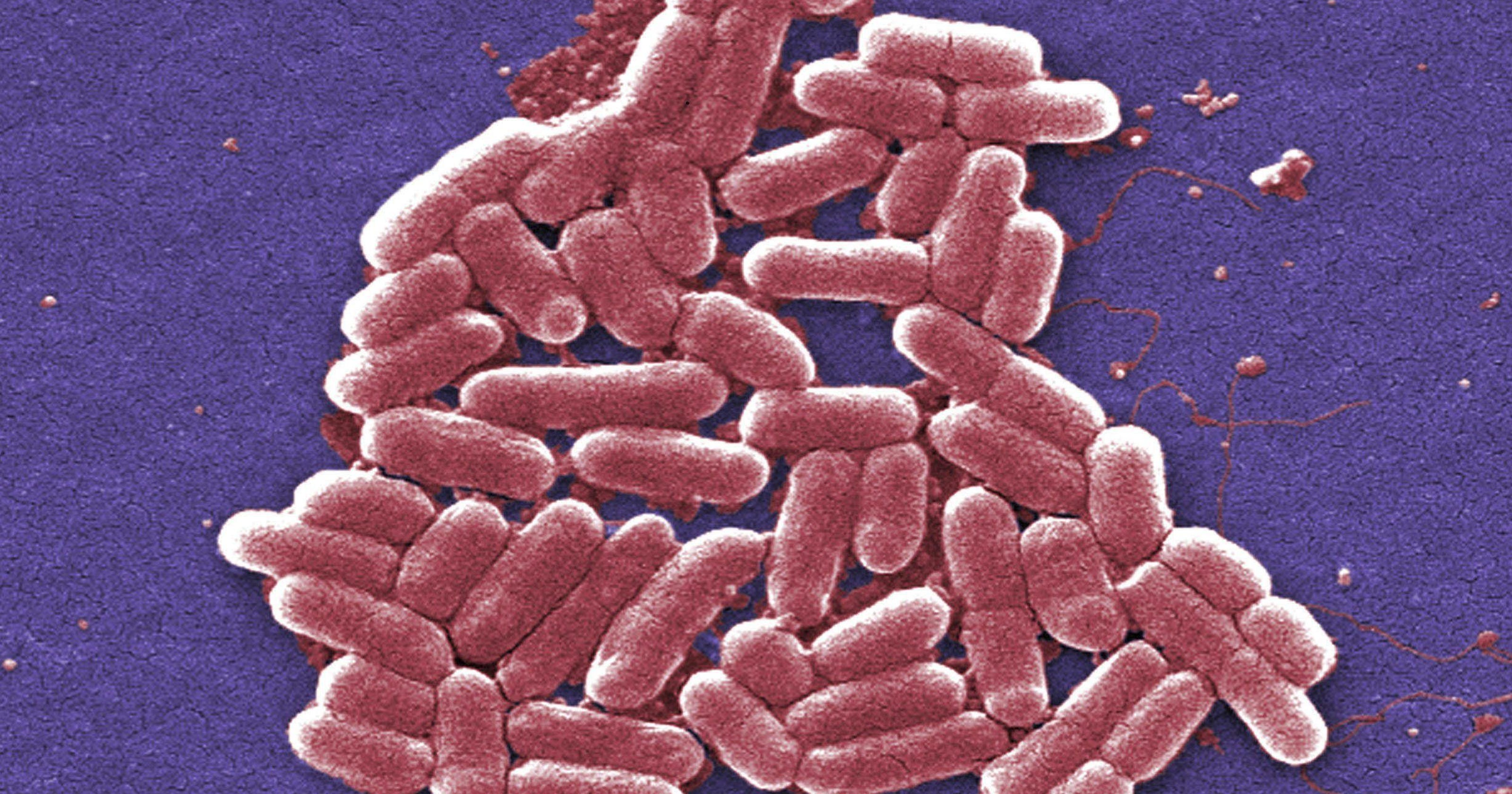 E. coli outbreak sickens dozens in Ohio and Kentucky
