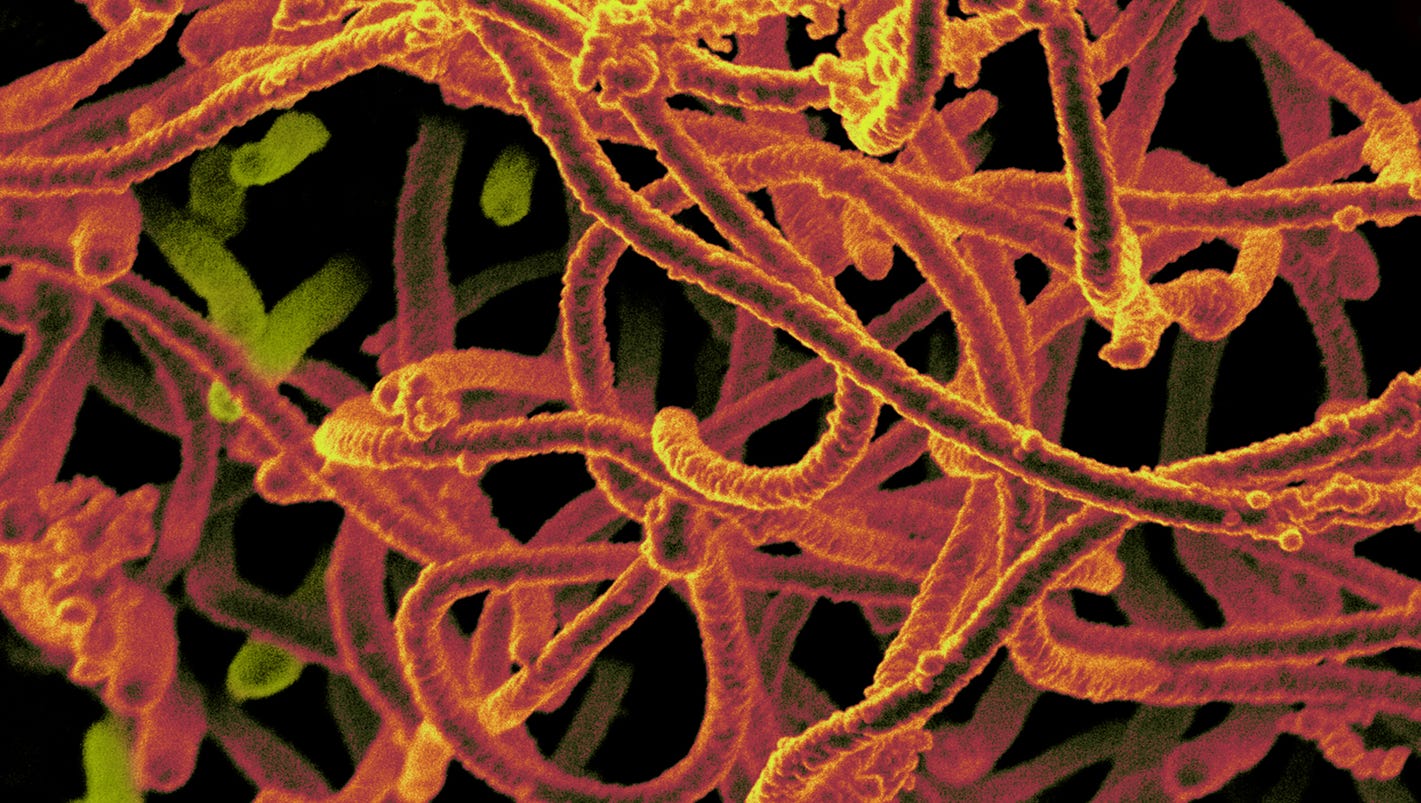 Tests Show Ebola Virus Not Dangerously Mutating