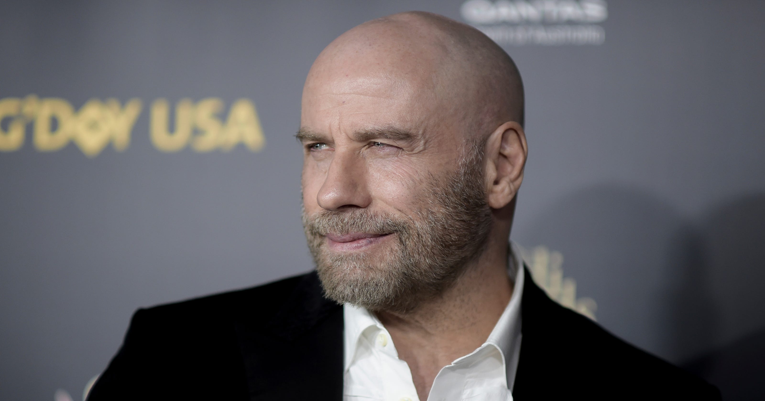 John Travolta: Bald head news is bigger than Oscar flub, credits Pitbull