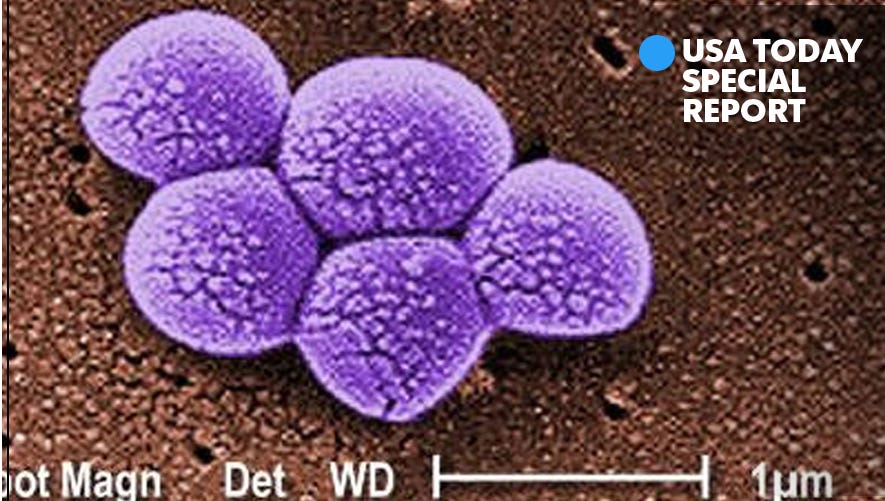 Mrsa Emergence of