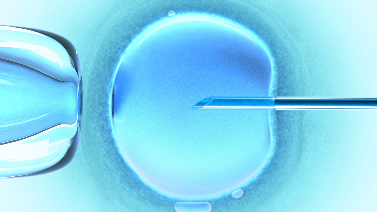 Fertility Doctor Allegedly Used Own Sperm In Procedure 