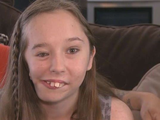 Teen With Facial Deformity Finds Reason To Smile 1355