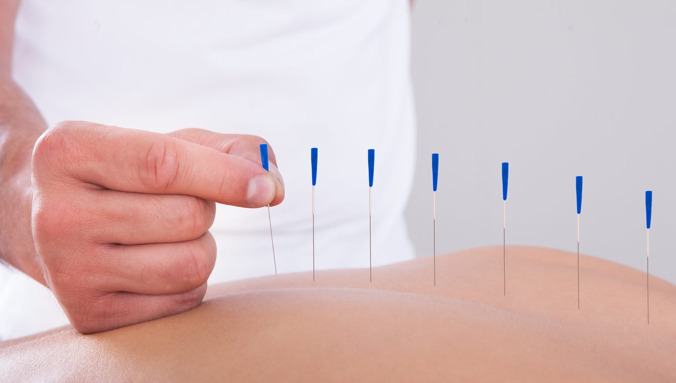 Acupuncture Can Help To Relieve Many Ailments