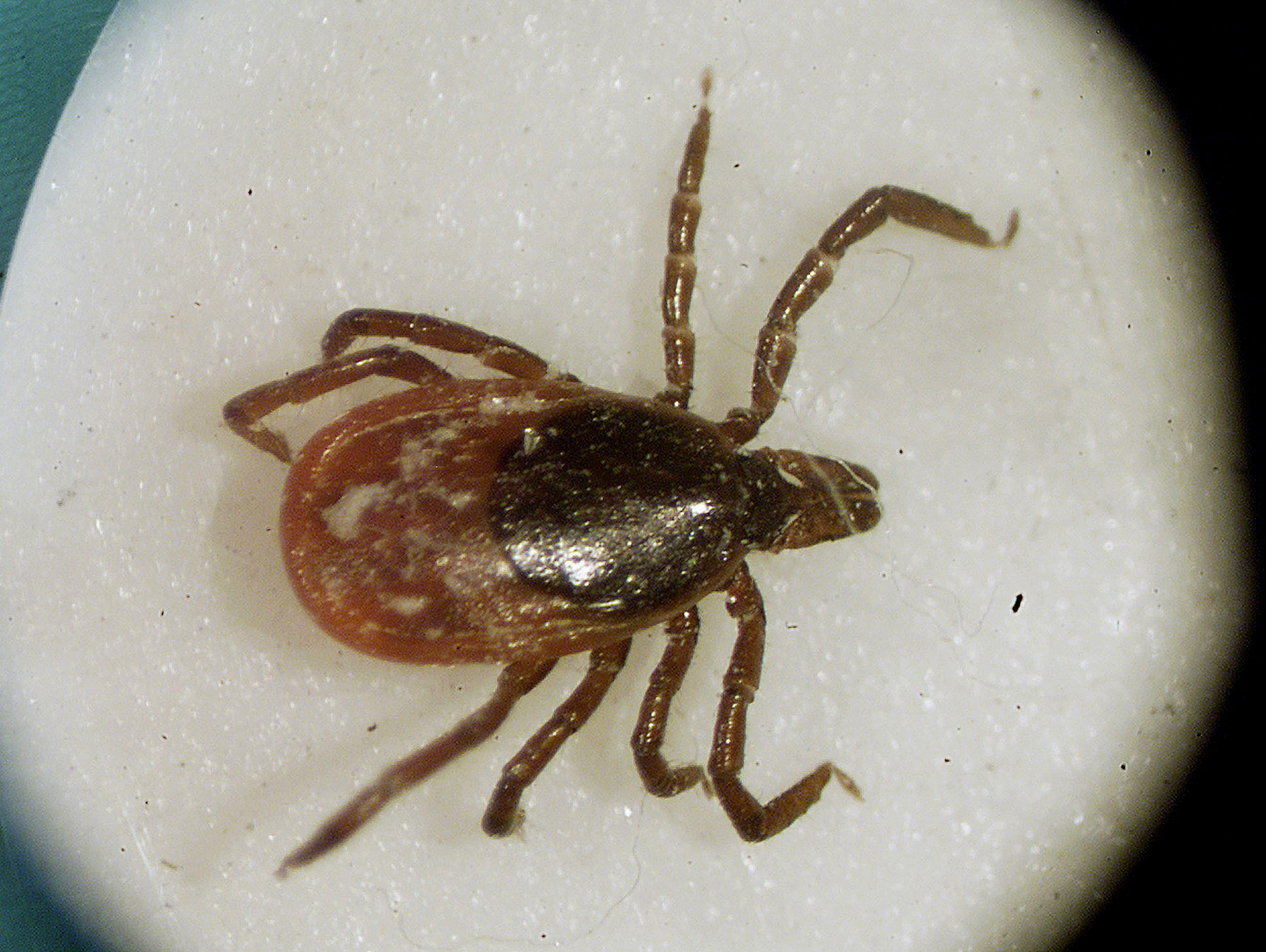 This is a March 2002 file photo of a deer tick under a microscope in the entomology lab at the University of Rhode Island in South Kingstown, R.I.