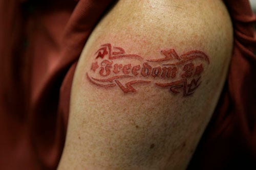 VanishInk Laser Tattoo Removal  Charlotte NC