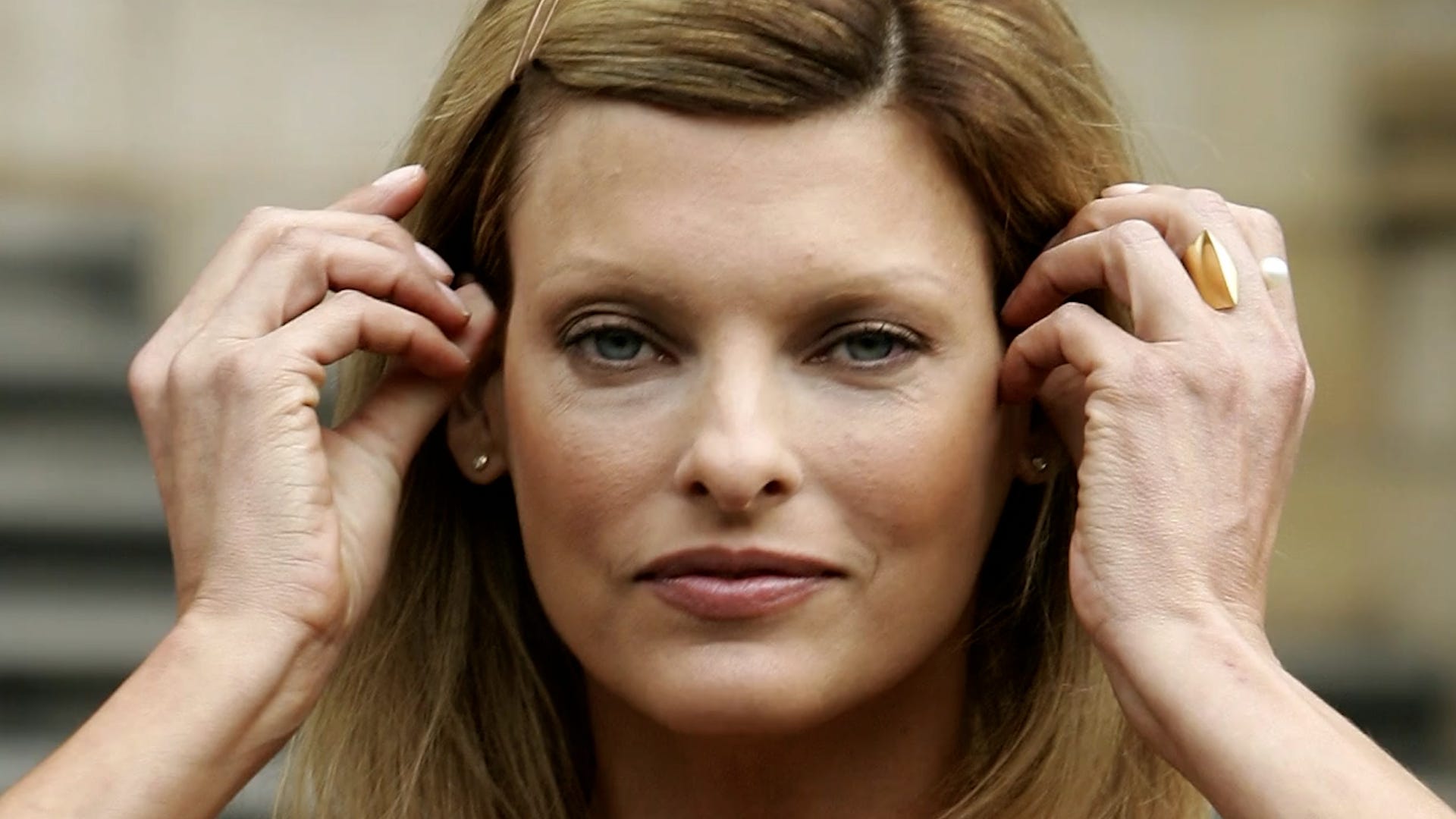 Linda Evangelista Claims She S Permanently Deformed Following