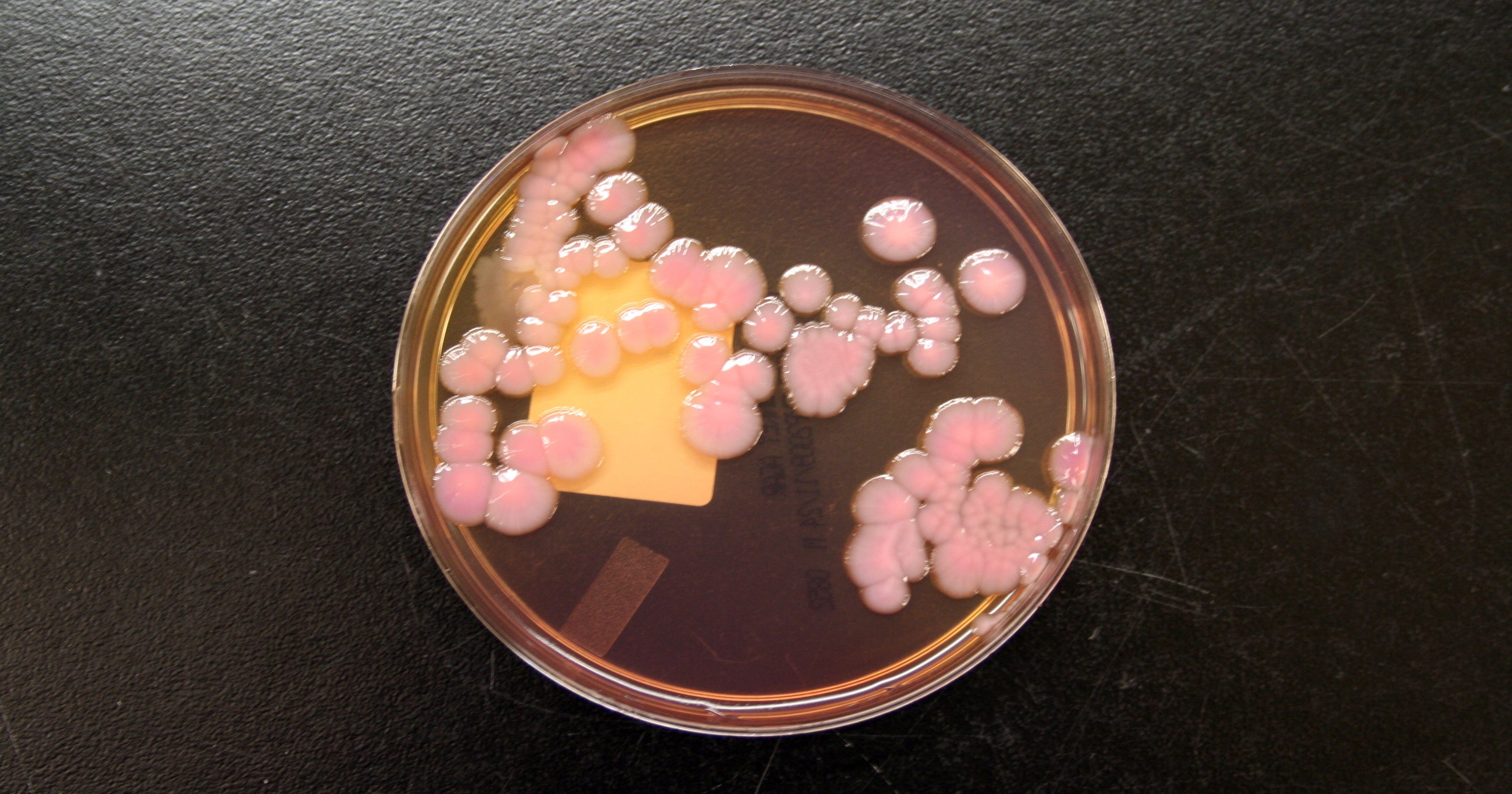 deadly-superbugs-invade-u-s-health-care-facilities