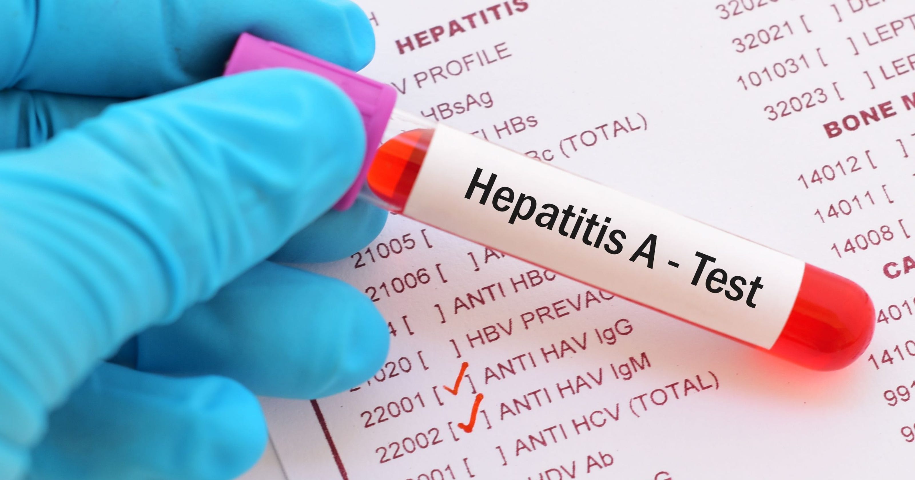most common hepatitis type