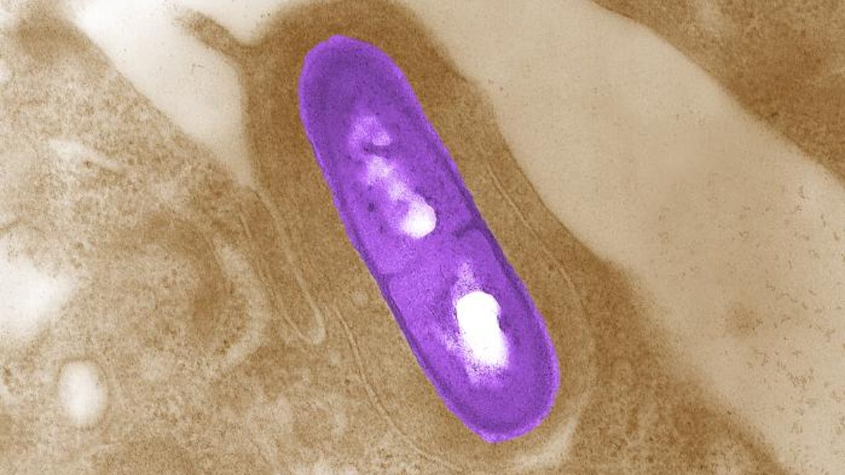 Electron micrograph of a Listeria bacterium in tissue. 