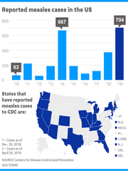 042919-measles epidemic