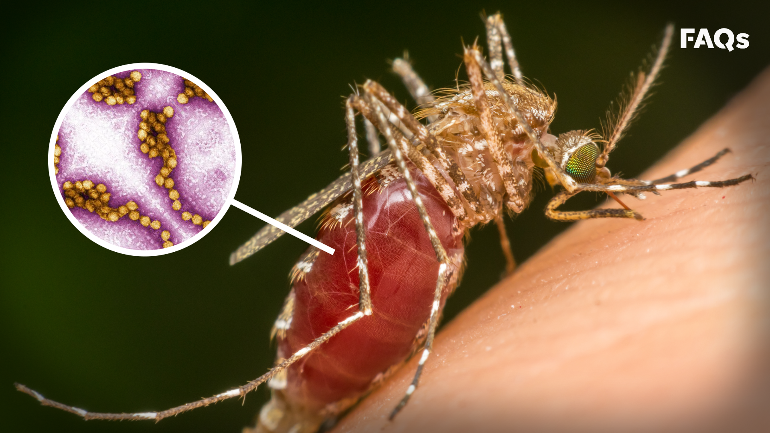 Mosquito season: How to identify symptoms of West Nile Virus