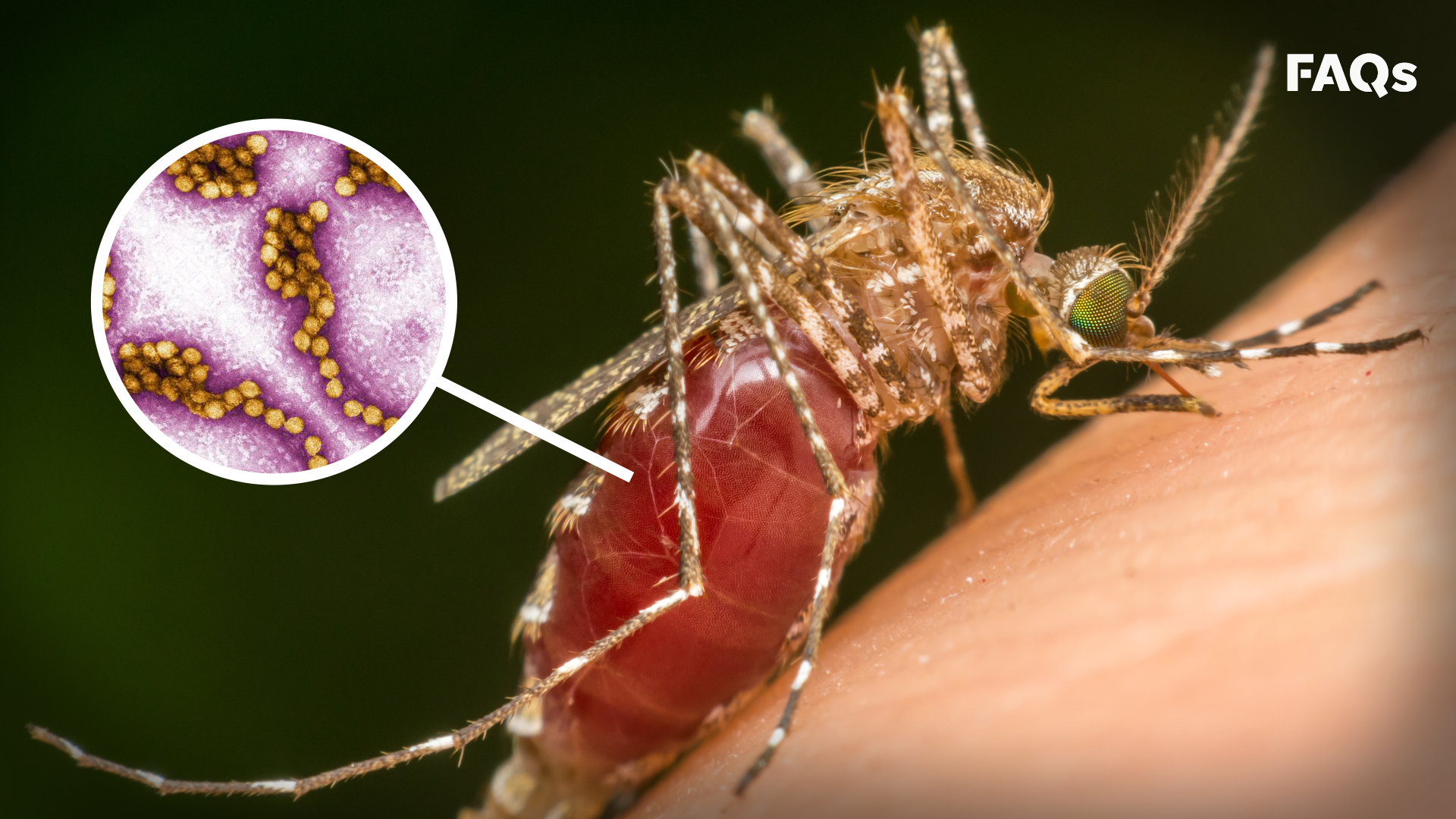 Leading symptoms of West Nile Virus, explained