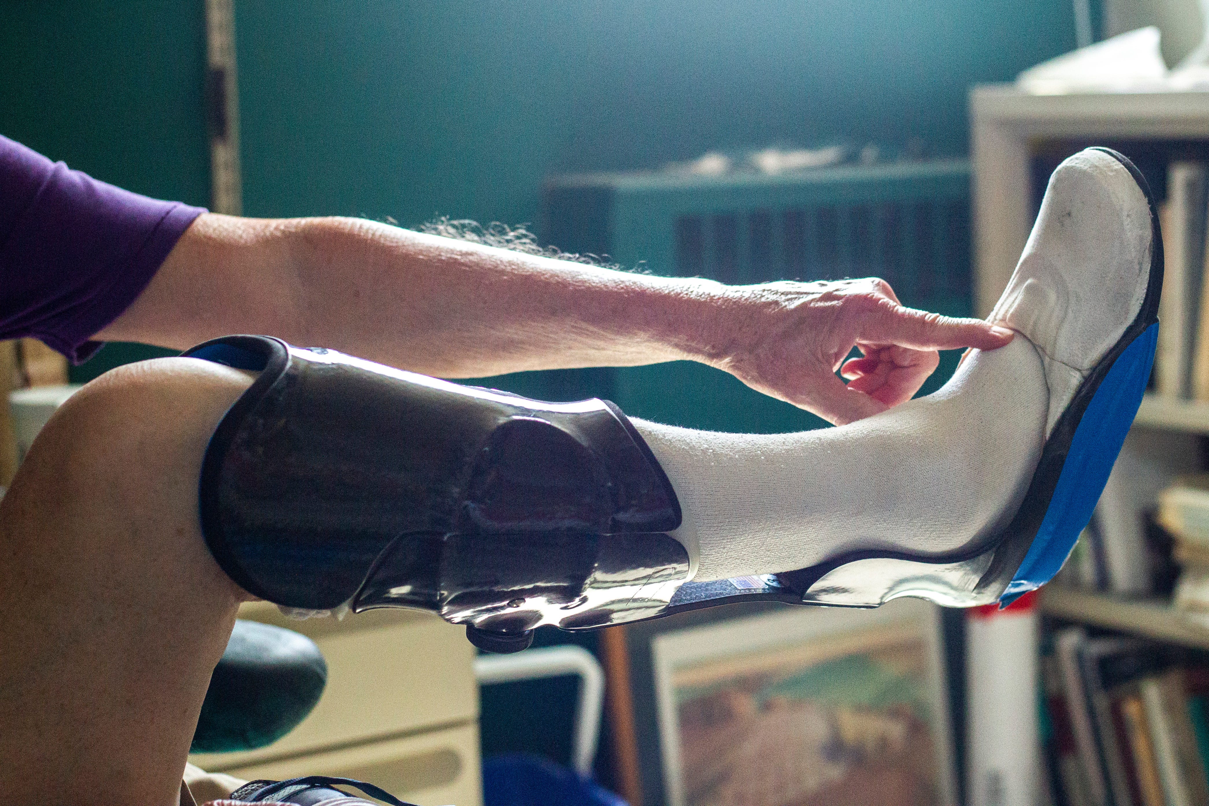 UI Research May Help Those With Severe Leg Injuries Walk With Ease