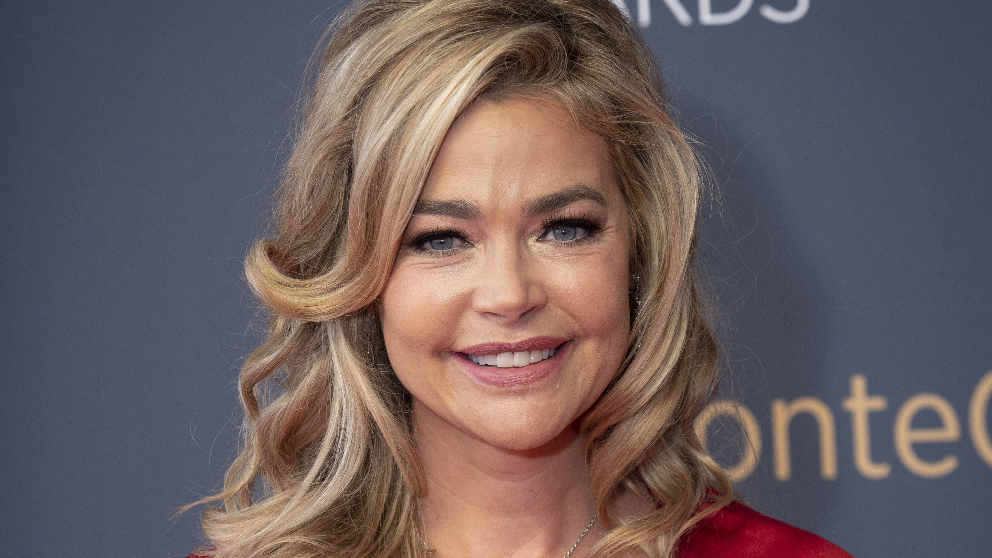 Denise Richards Real Housewives Of Beverly Hills Fans Saw Thyroid