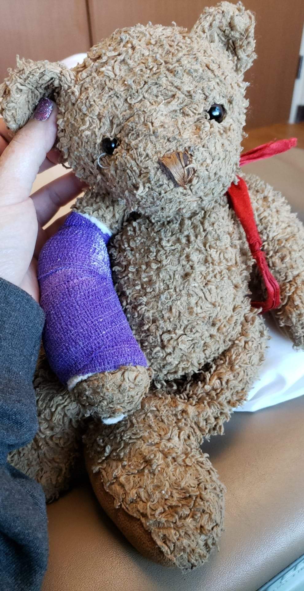 teddy bear with cast on arm