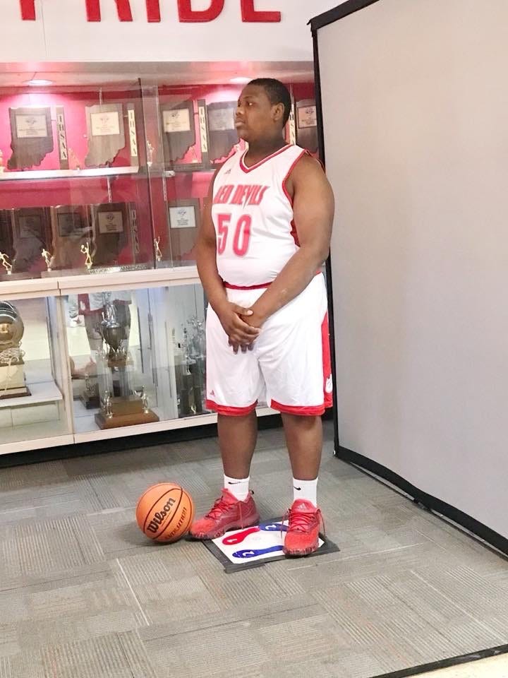 Jeffersonville Boys Basketball Player Survives A Heart Attack