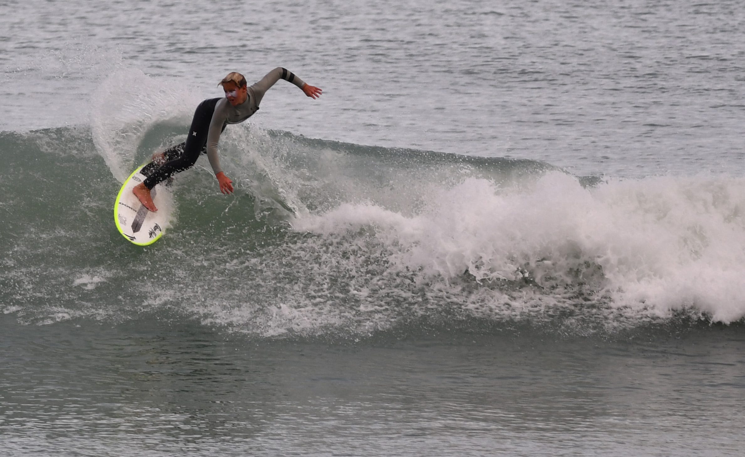 Logan Radd Wins Usa Surfing Prime Contest Months After Shark Bite