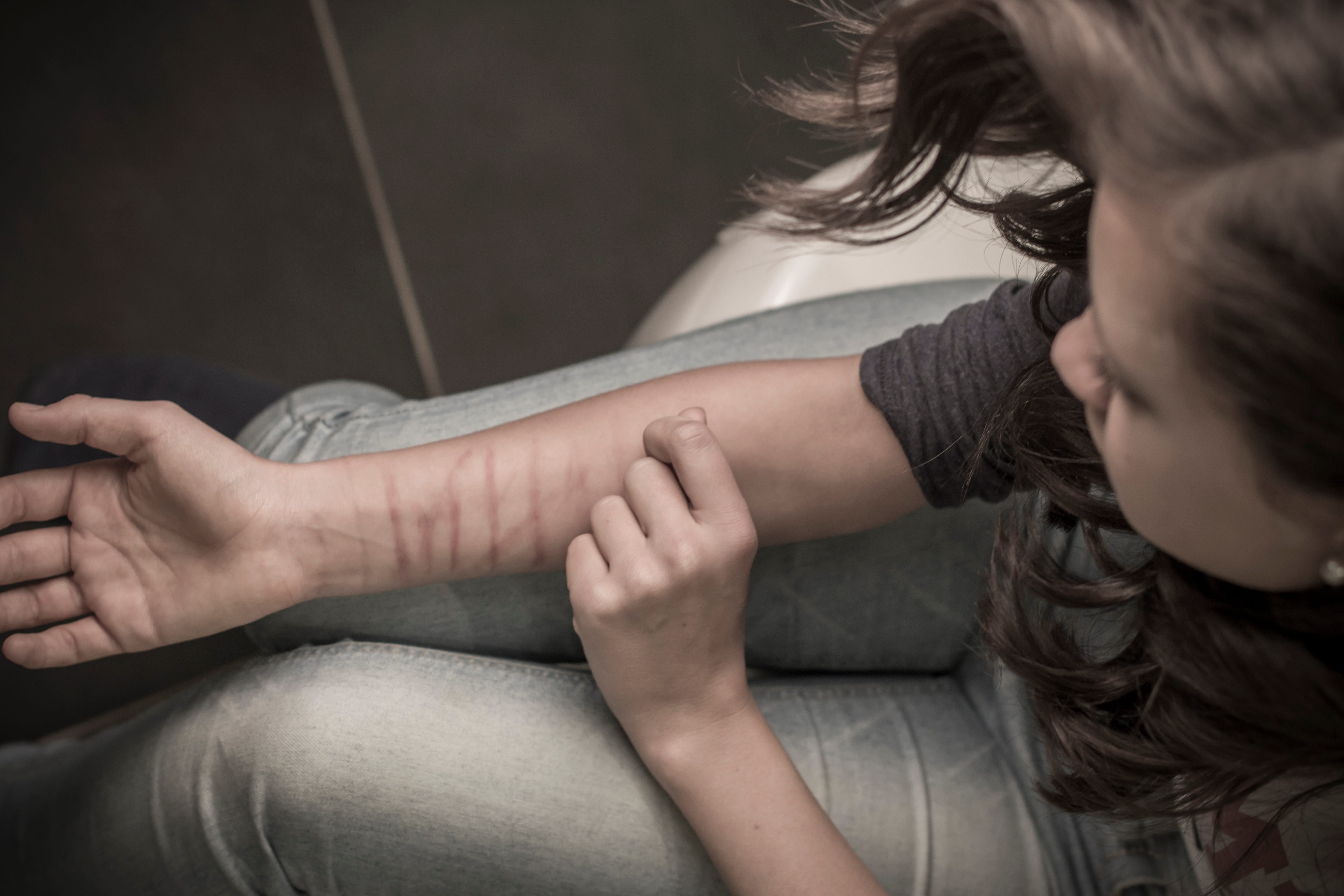 Self Harm Isn T Necessarily An Attempt At Suicide It Is A Cry For Help   45d43aea 823f 4d89 Bd47 56fcf710fdf4 GettyImages 178897619 