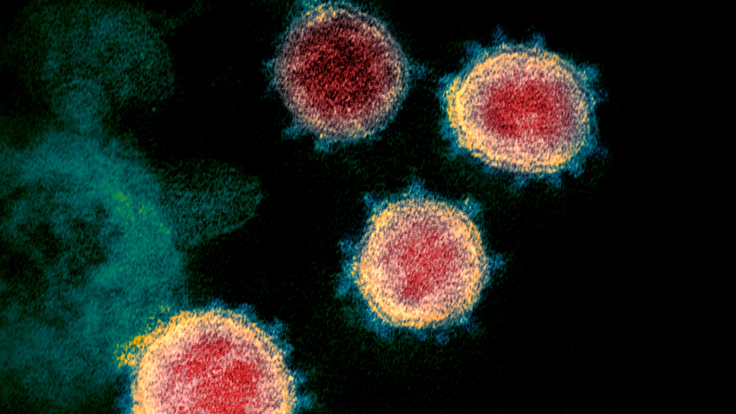 Statewide coronavirus update: Indiana reports 6,199 cases, 69 deaths