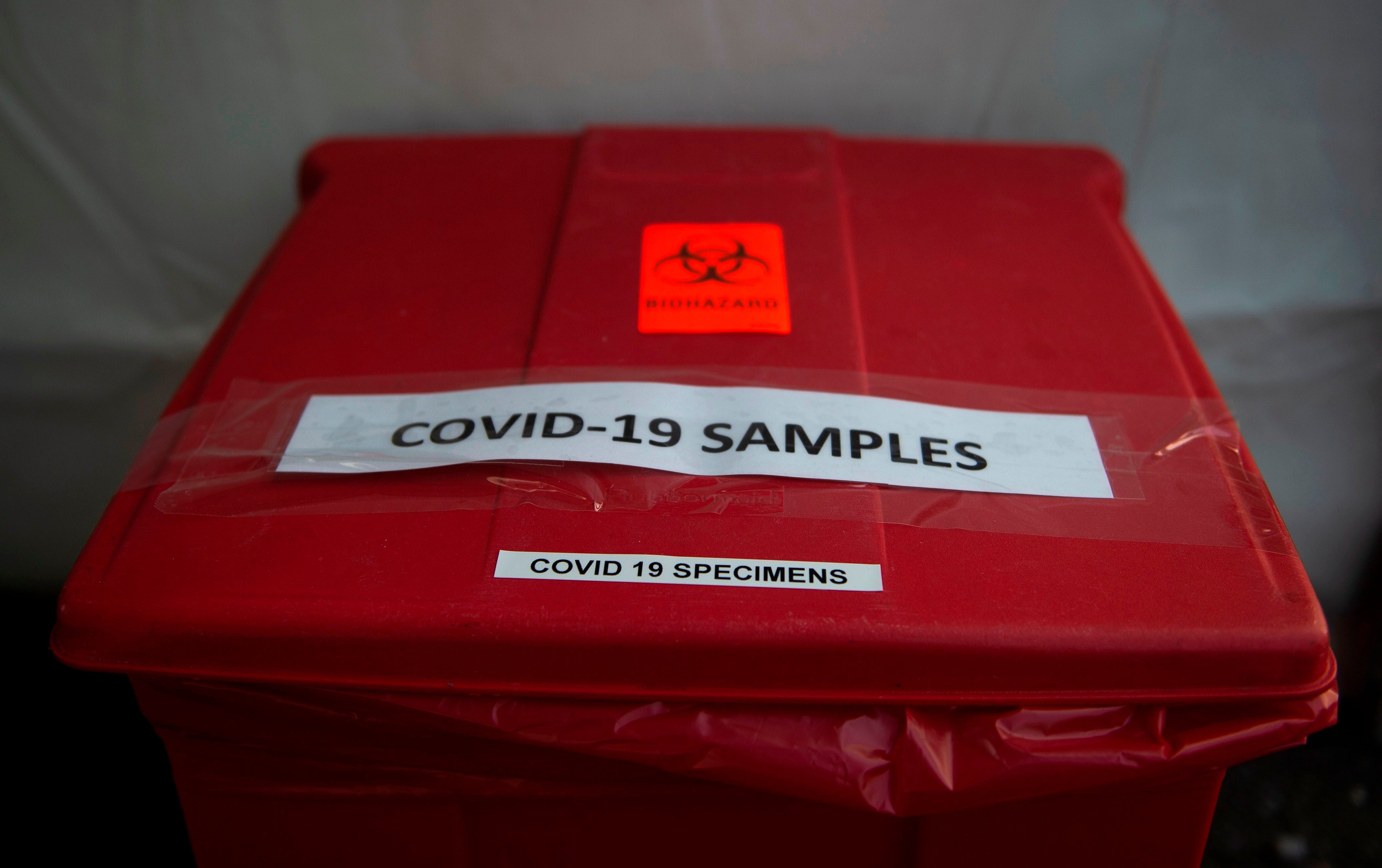 Mundskyl Joseph Banks erfaring Take coronavirus precautions if a housemate has symptoms like a cough