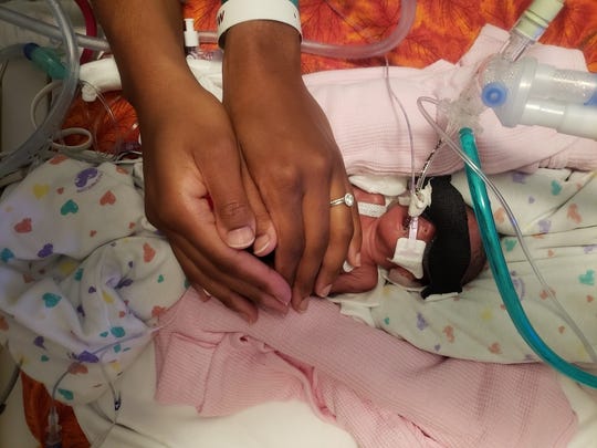 Preemie twin Kalais Morgan checked in at just 1 pound, 7 ounces.