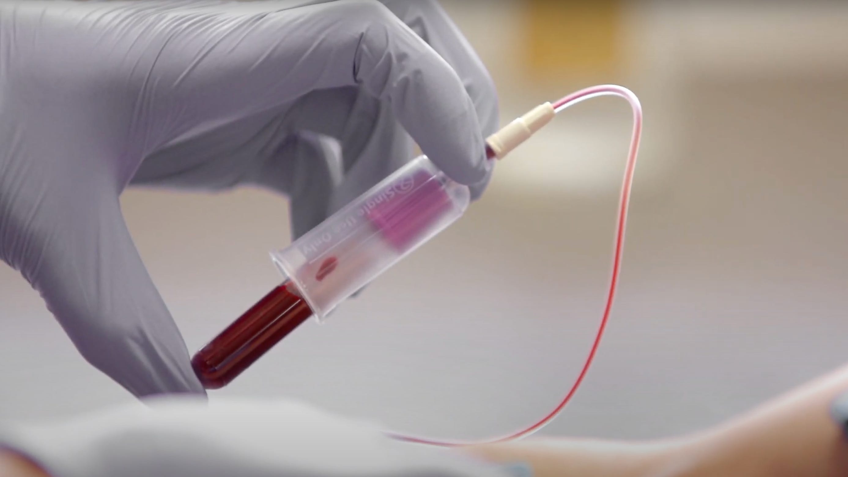 Cancer: FDA approves liquid biopsy tests that can improve treatment