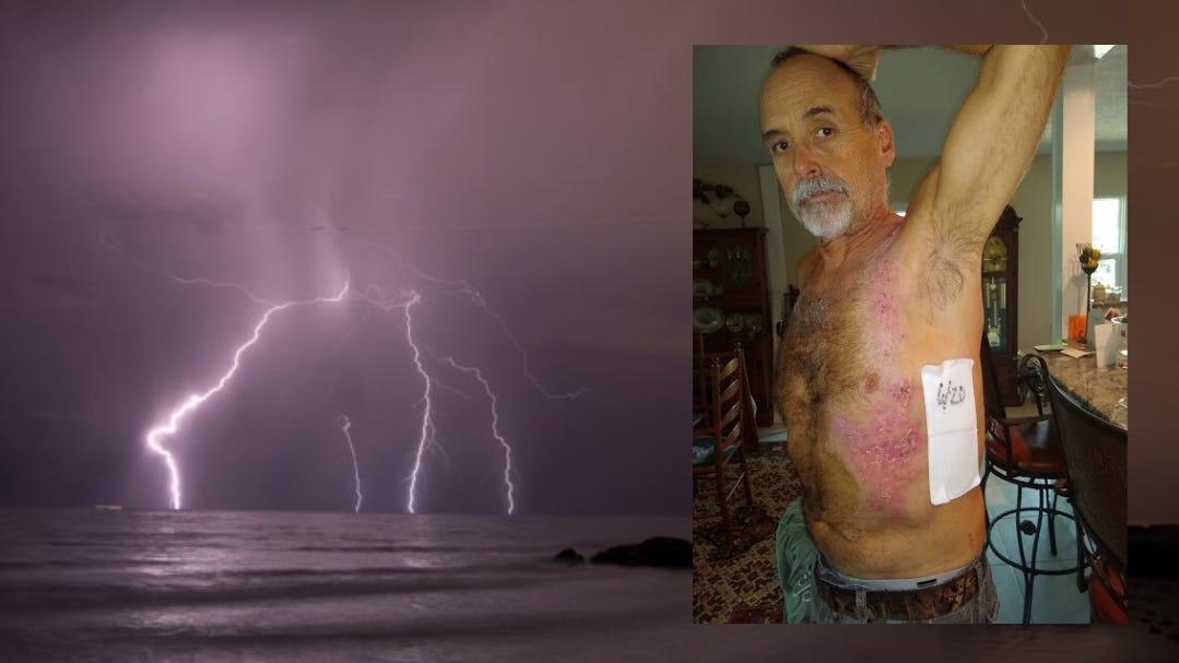 No pulse': Florida father, son live to tell a miracle lightning tale