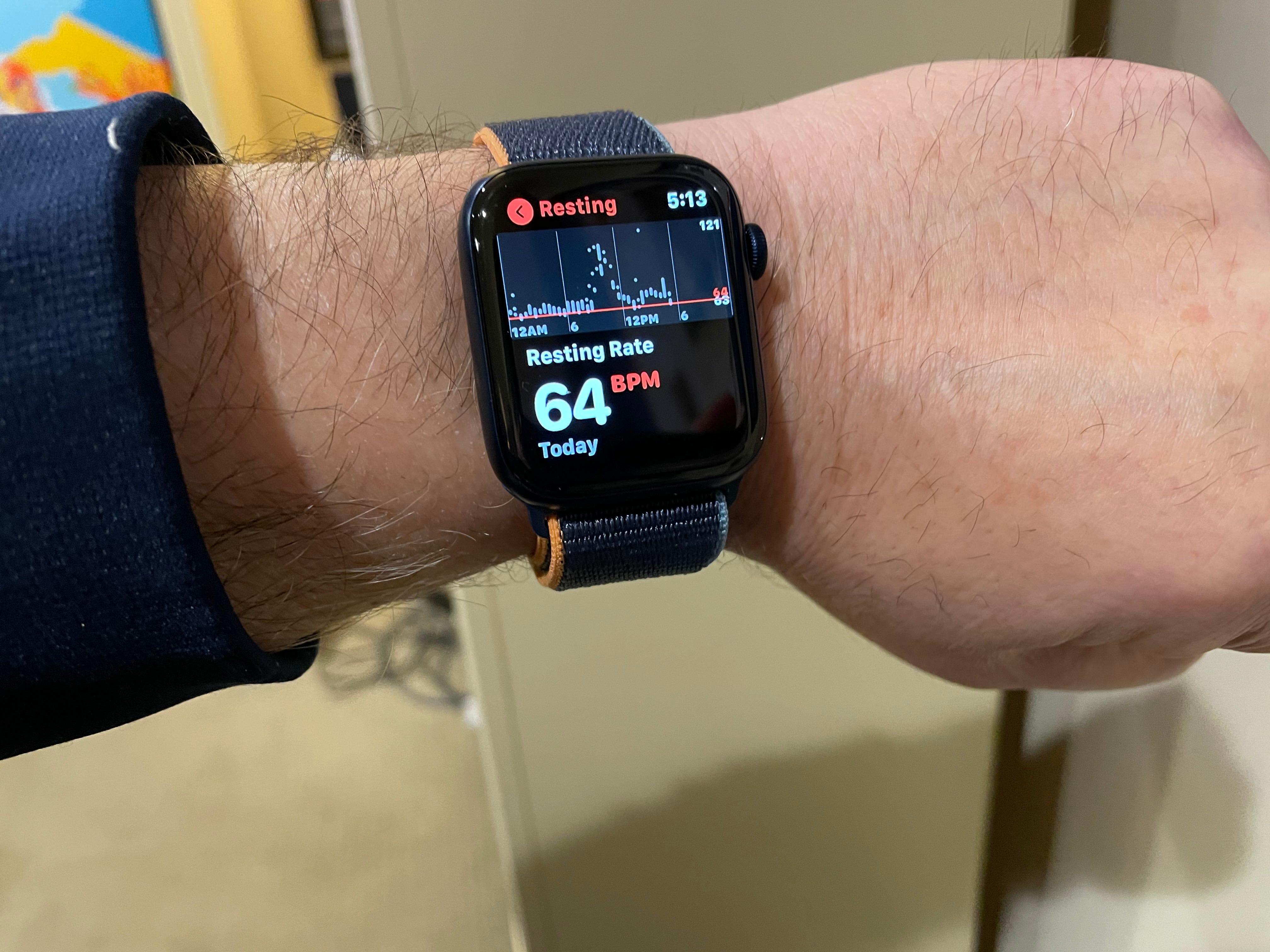 can i transfer my fitbit data to apple watch