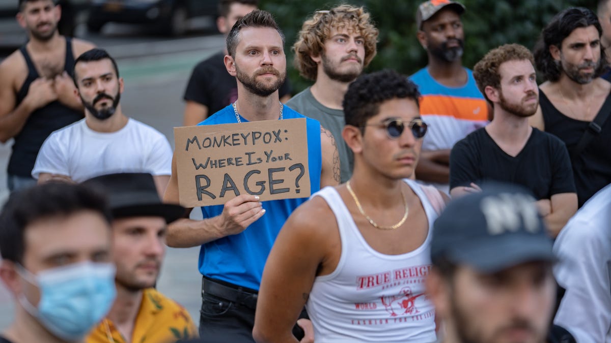 People protest during a rally calling for more government action to combat the spread of monkeypox at Foley Square on July 21, 2022, in New York City. At least 267 New Yorkers have tested positive for monkeypox, a virus similar to smallpox but with milder symptoms.