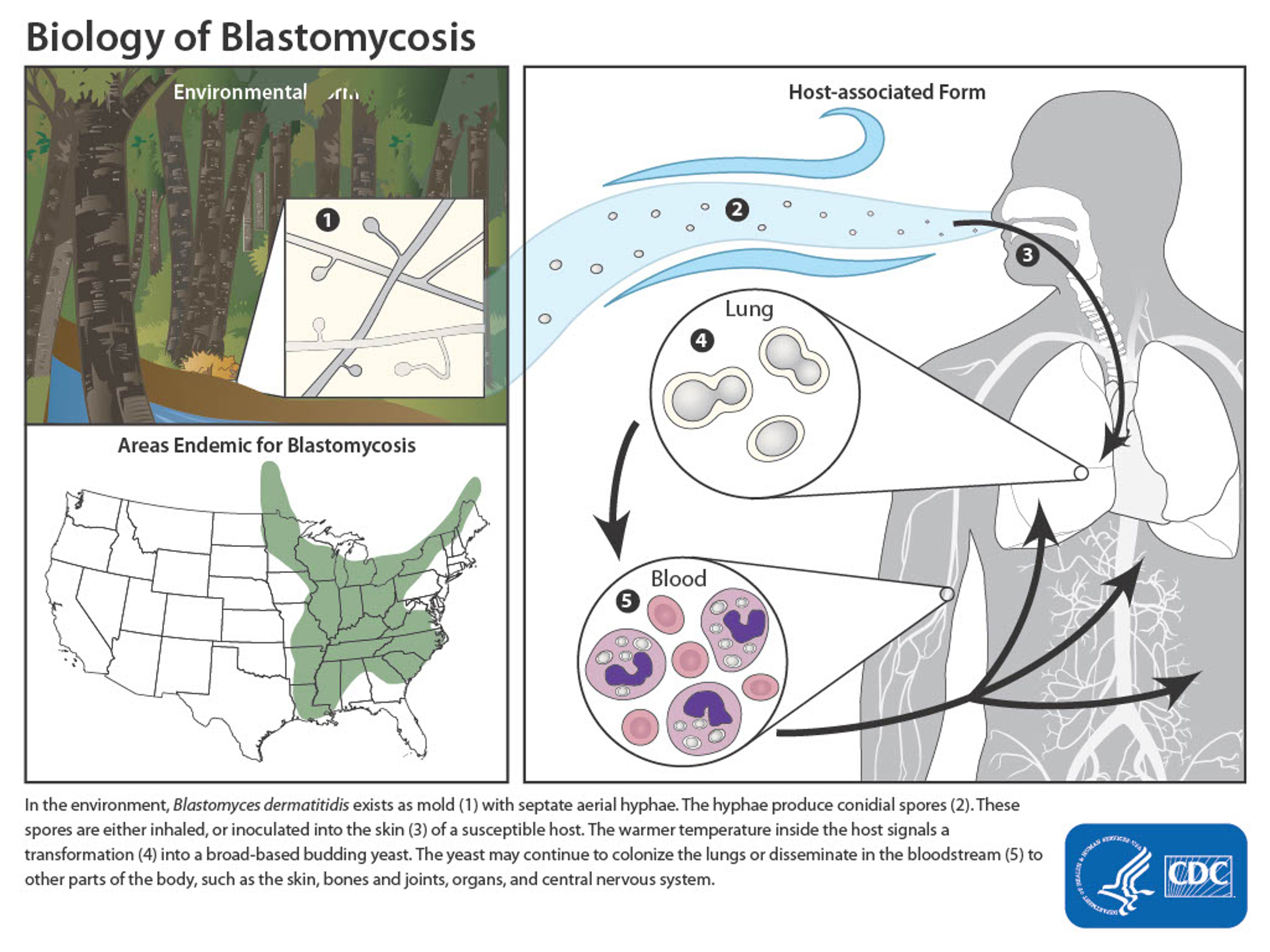 Blastomycosis outbreak inquiry goes on at Billerud's Escanaba mill